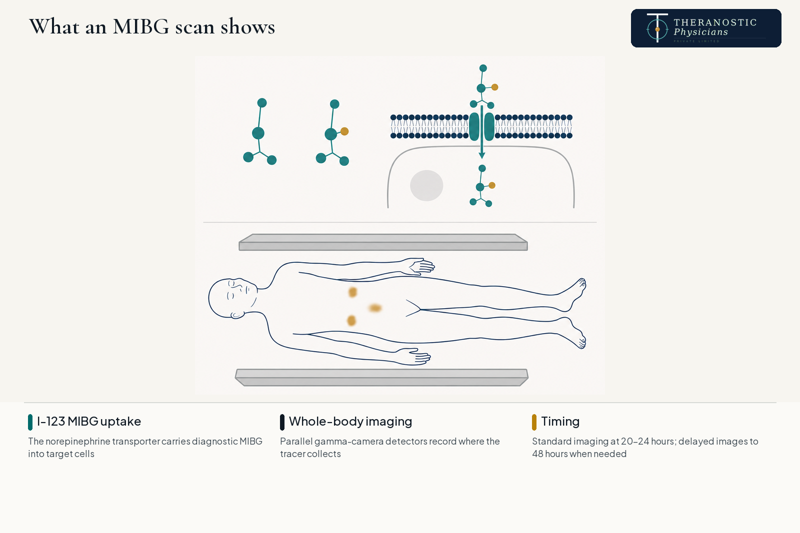 Diagram showing I-123 MIBG uptake through the norepinephrine transporter and whole-body gamma camera imaging at 24 hours.