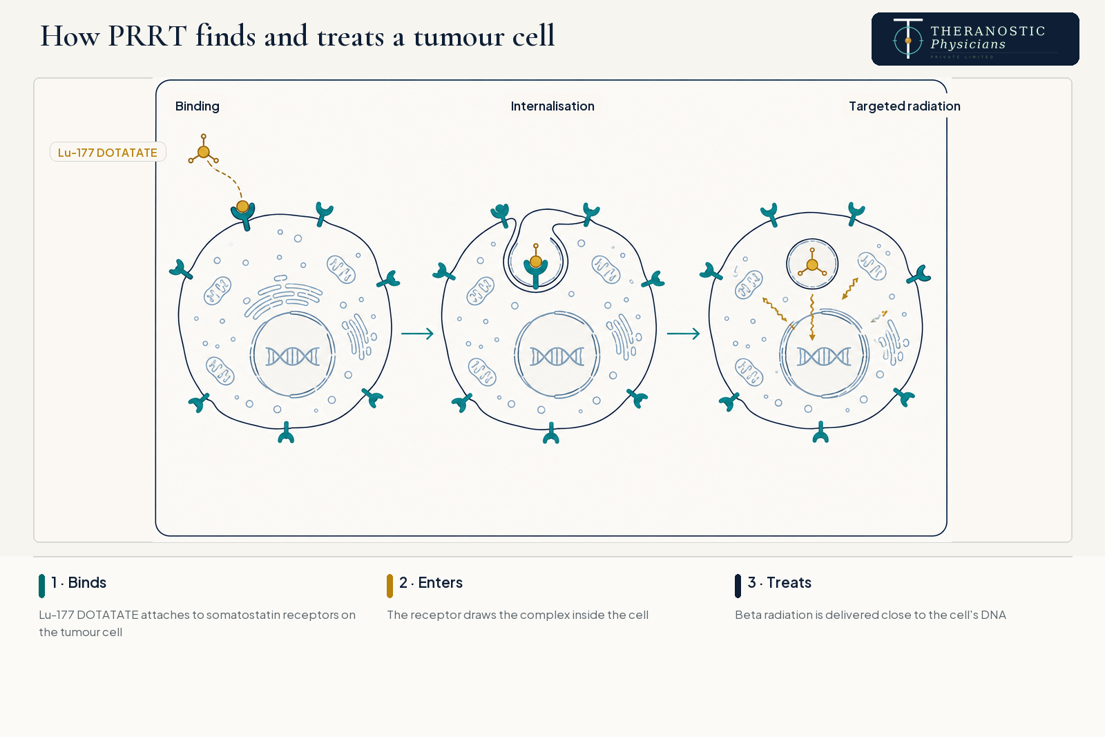 Three-stage diagram showing Lu-177 DOTATATE binding to a somatostatin receptor, entering a tumour cell and delivering beta radiation near its DNA.