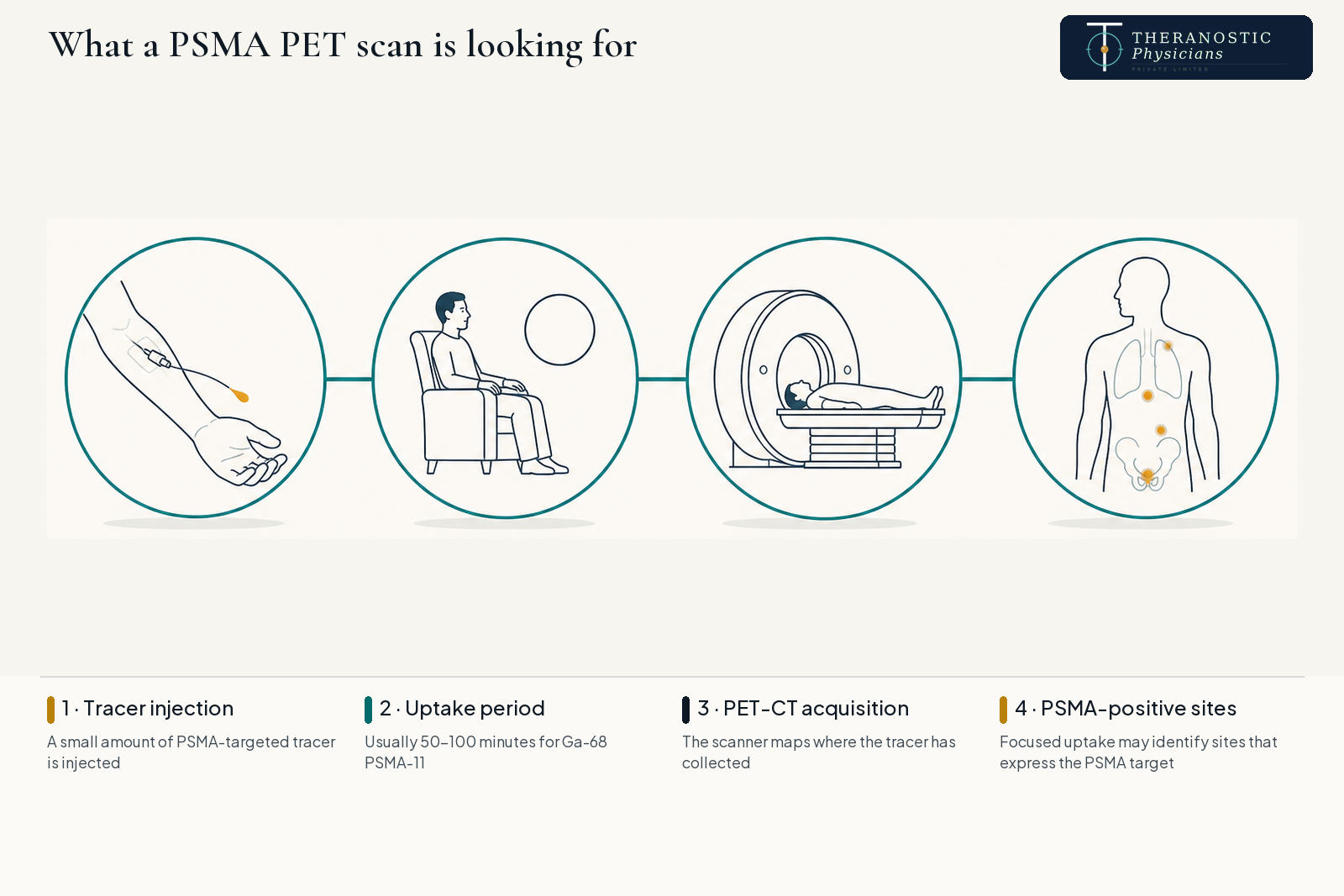 Four-step infographic of a PSMA PET scan: tracer injection, uptake period, PET-CT acquisition, and tracer concentrating at PSMA-positive sites.
