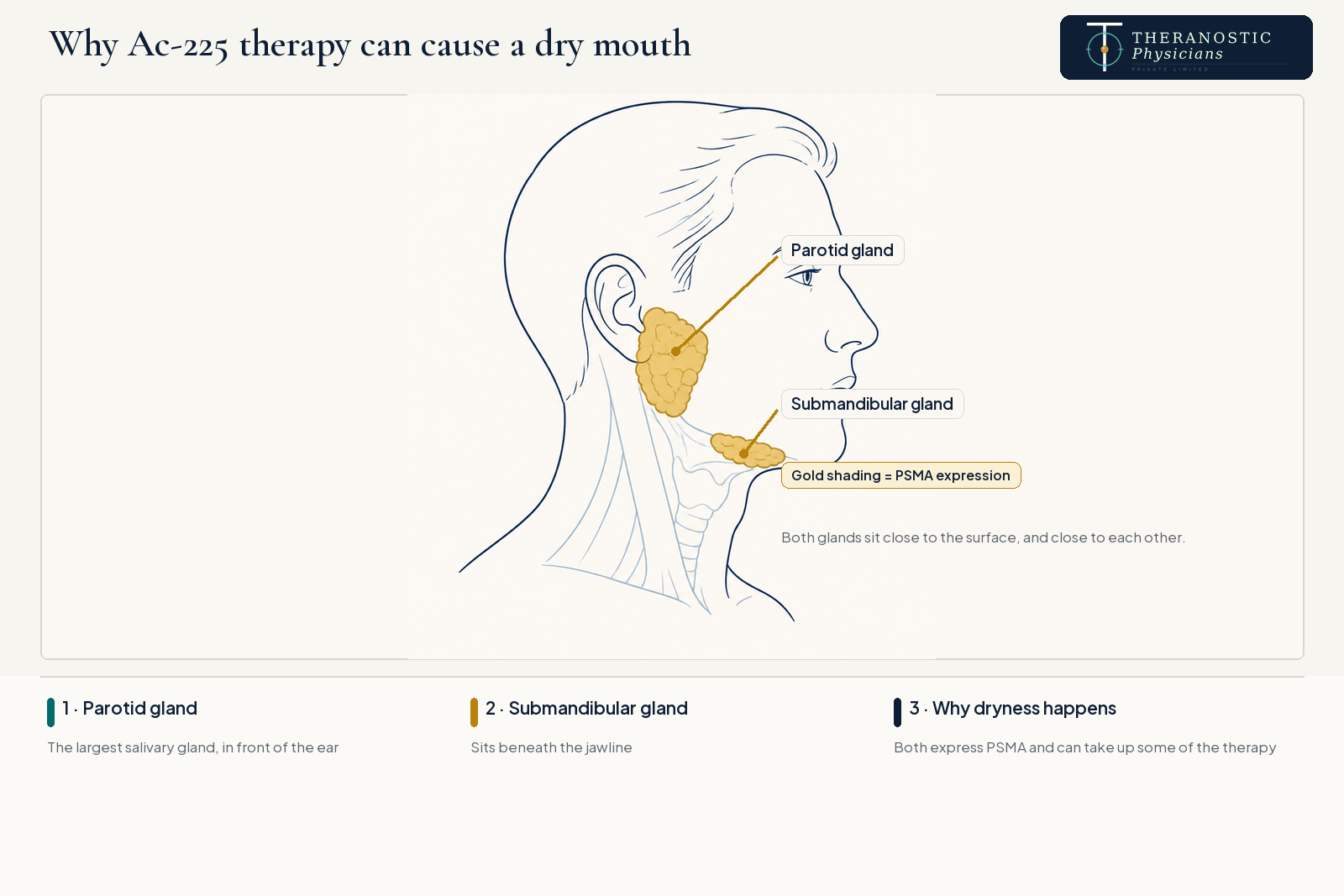 Side-profile anatomy diagram highlighting the parotid gland near the ear and the submandibular gland beneath the jaw as sites of PSMA expression.