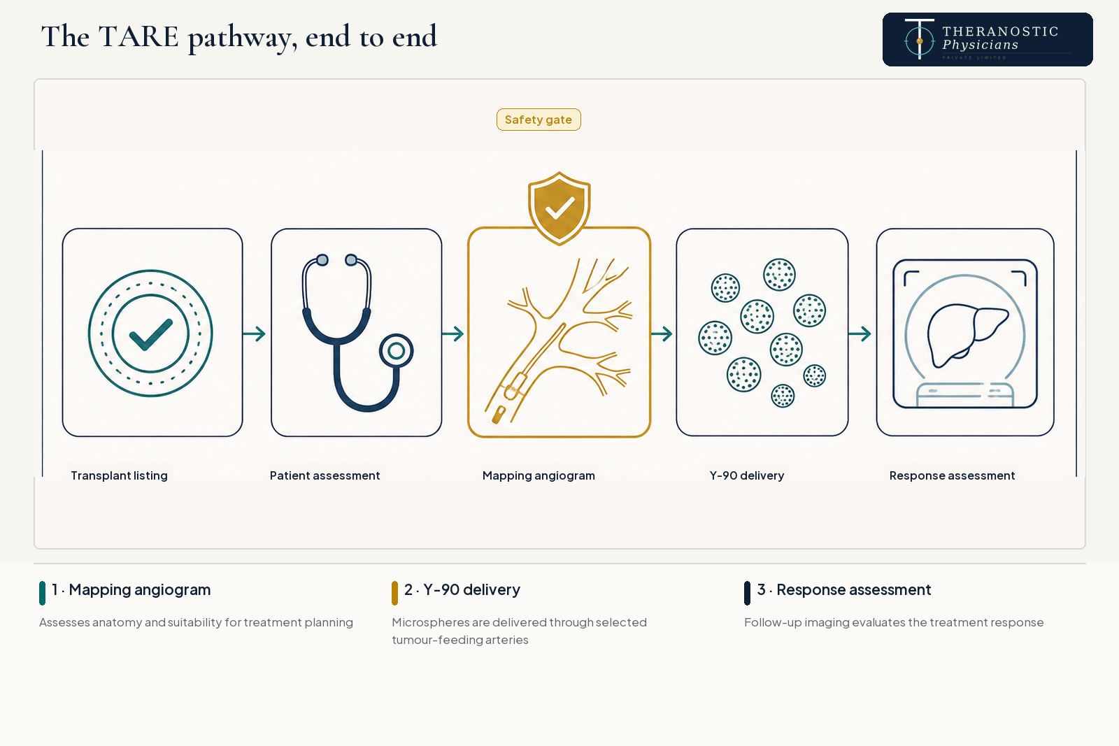 Five-step TARE pathway showing transplant listing, patient assessment, mapping angiogram, Y-90 delivery and follow-up response assessment.