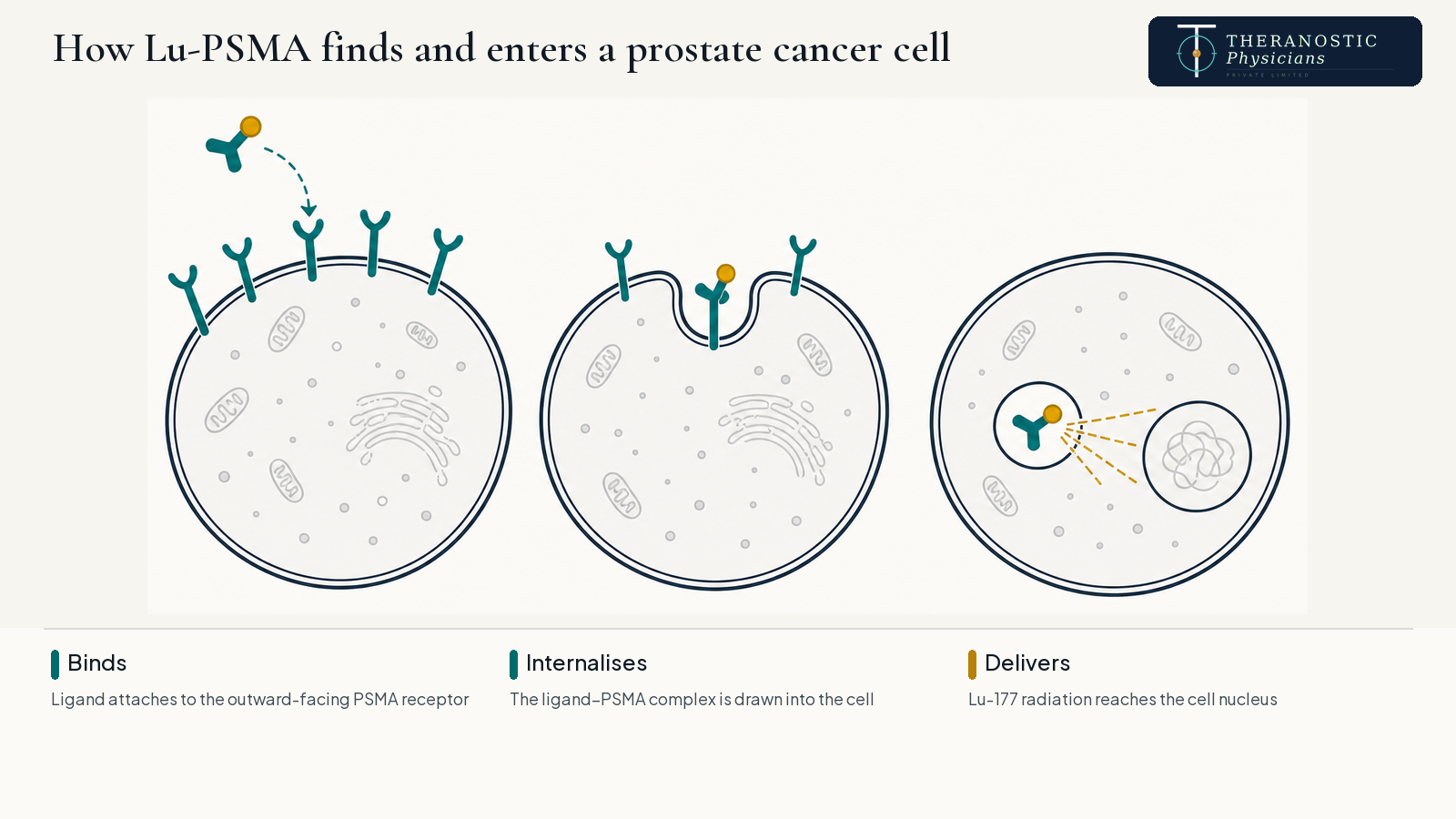 Three-stage diagram showing Lu-177 PSMA-617 binding the PSMA receptor, internalising into the prostate cancer cell, and irradiating the nucleus.